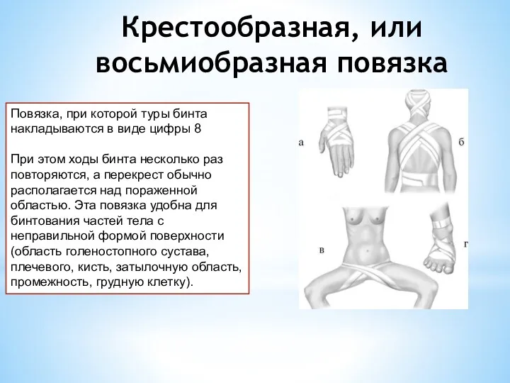 Крестообразная, или восьмиобразная повязка Повязка, при которой туры бинта накладываются