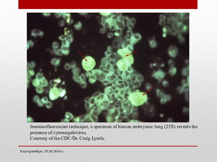 Екатеринбург, 18.10.2016 г. Immunofluorescent technique, a specimen of human embryonic lung (25X) reveals