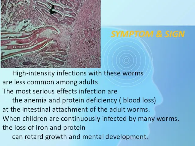 High-intensity infections with these worms are less common among adults.