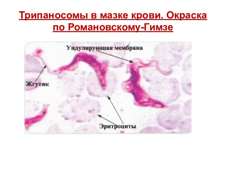 Трипаносомы в мазке крови. Окраска по Романовскому-Гимзе