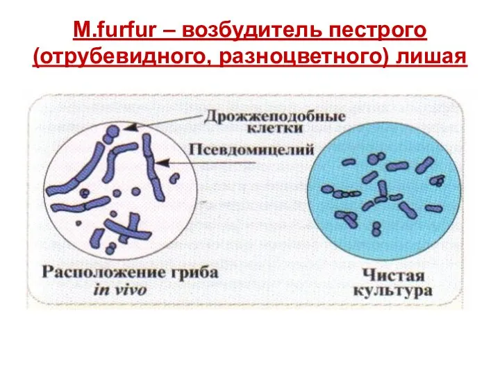 M.furfur – возбудитель пестрого (отрубевидного, разноцветного) лишая