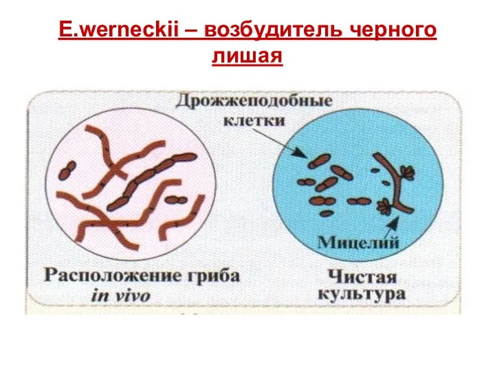 E.werneckii – возбудитель черного лишая