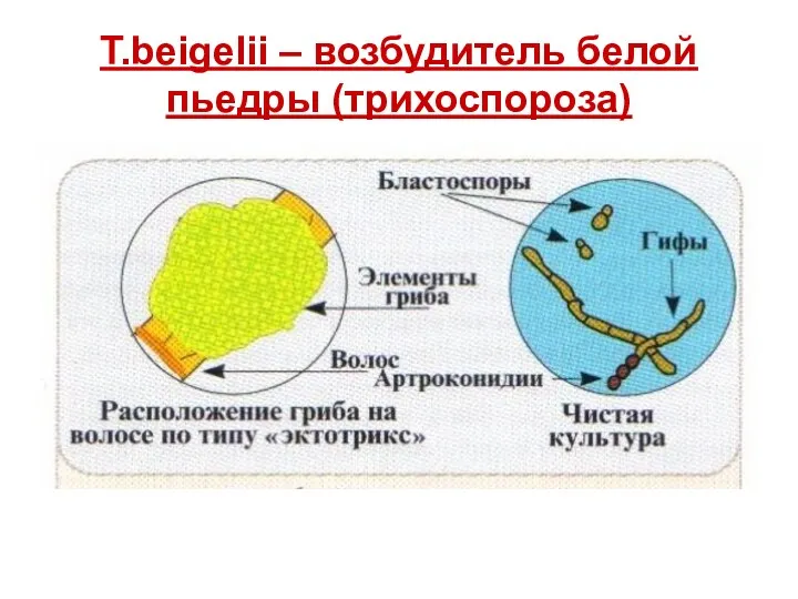 T.beigelii – возбудитель белой пьедры (трихоспороза)