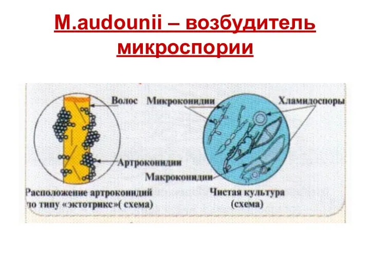 M.audounii – возбудитель микроспории
