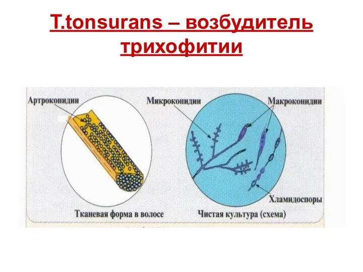 T.tonsurans – возбудитель трихофитии