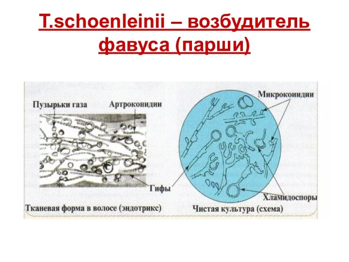 T.schoenleinii – возбудитель фавуса (парши)