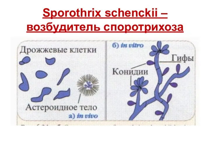 Sporothrix schenckii – возбудитель споротрихоза