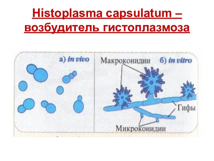 Histoplasma capsulatum – возбудитель гистоплазмоза