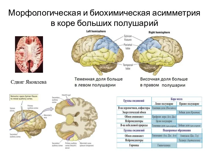 Морфологическая и биохимическая асимметрия в коре больших полушарий Сдвиг Яковлева