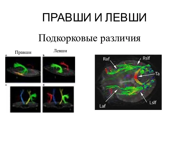 ПРАВШИ И ЛЕВШИ Подкорковые различия Правши Левши