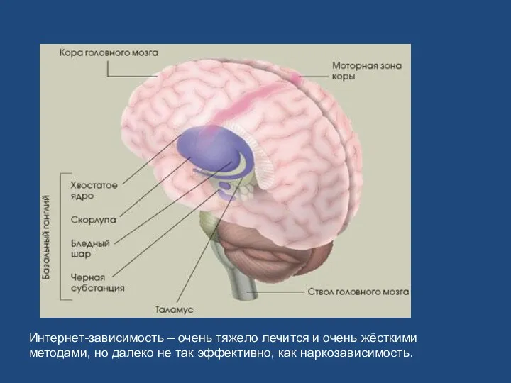 Интернет-зависимость – очень тяжело лечится и очень жёсткими методами, но далеко не так эффективно, как наркозависимость.