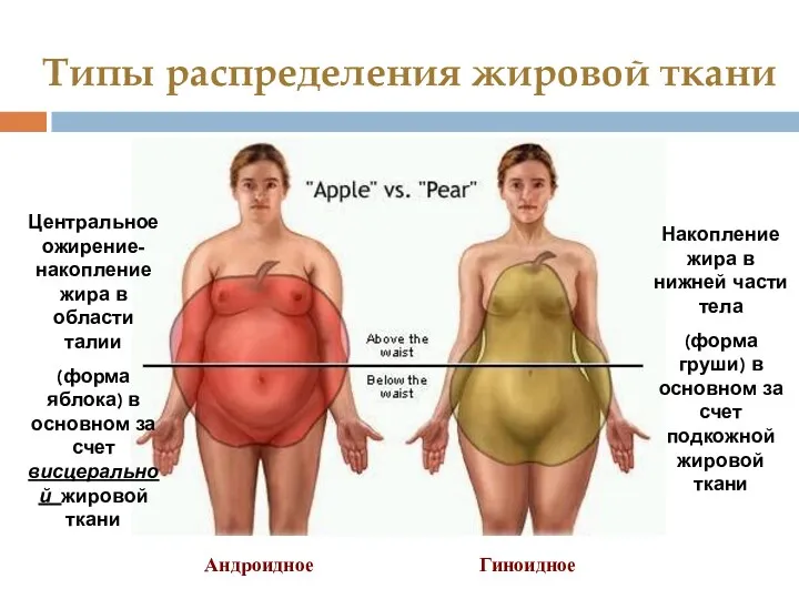 Типы распределения жировой ткани Центральное ожирение- накопление жира в области талии (форма яблока)