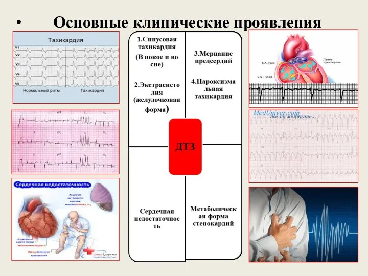 Основные клинические проявления