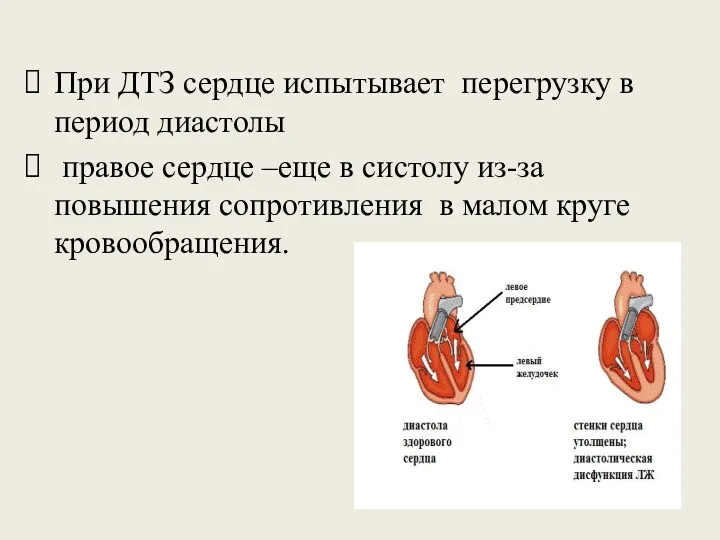 При ДТЗ сердце испытывает перегрузку в период диастолы правое сердце