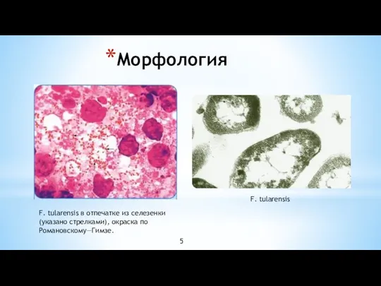 Морфология F. tularensis в отпечатке из селезенки (указано стрелками), окраска по Романовскому—Гимзе. F. tularensis 5