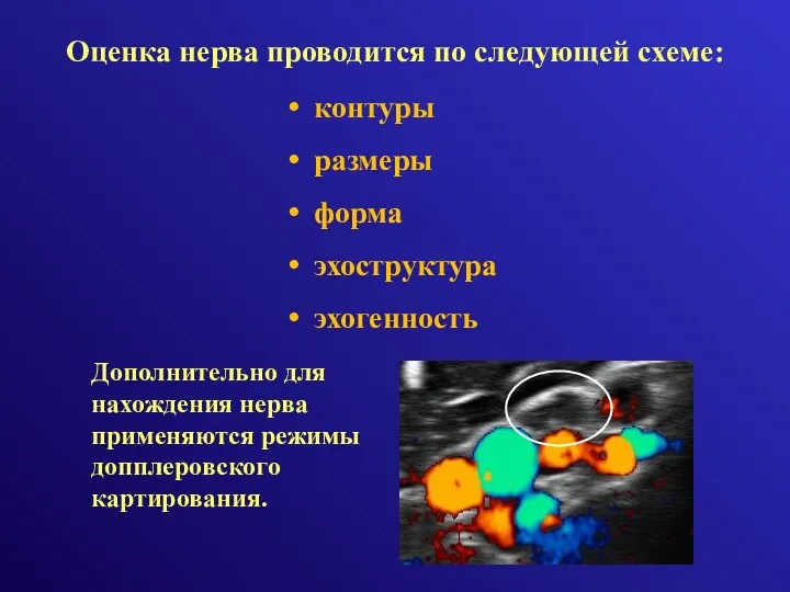 Оценка нерва проводится по следующей схеме: Дополнительно для нахождения нерва