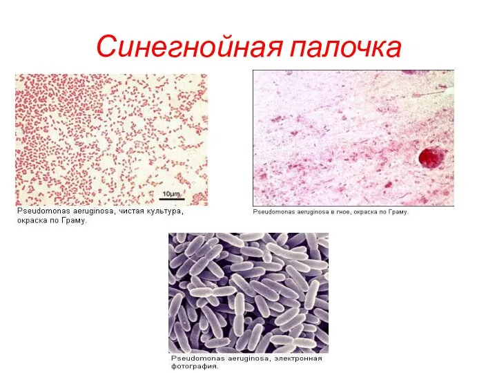 Синегнойная палочка