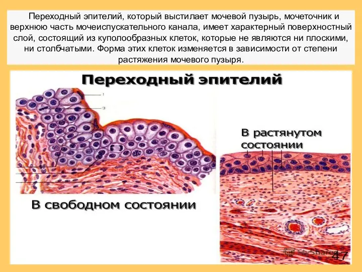 Переходный эпителий, который выстилает мочевой пузырь, мочеточник и верхнюю часть