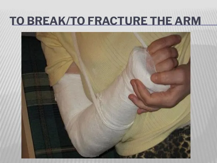 TO BREAK/TO FRACTURE THE ARM