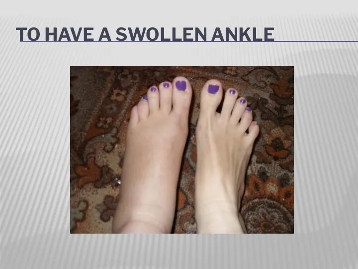 TO HAVE A SWOLLEN ANKLE