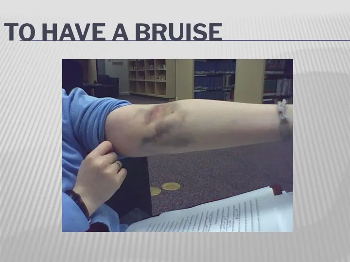 TO HAVE A BRUISE