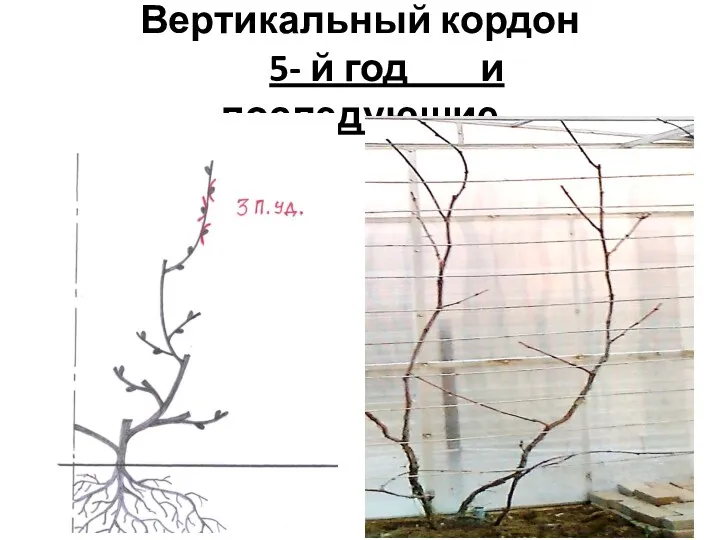 Вертикальный кордон 5- й год и последующие