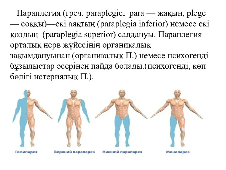 Параплегия (греч. paraplegie, para — жақын, plege — соққы)—екі аяқтың