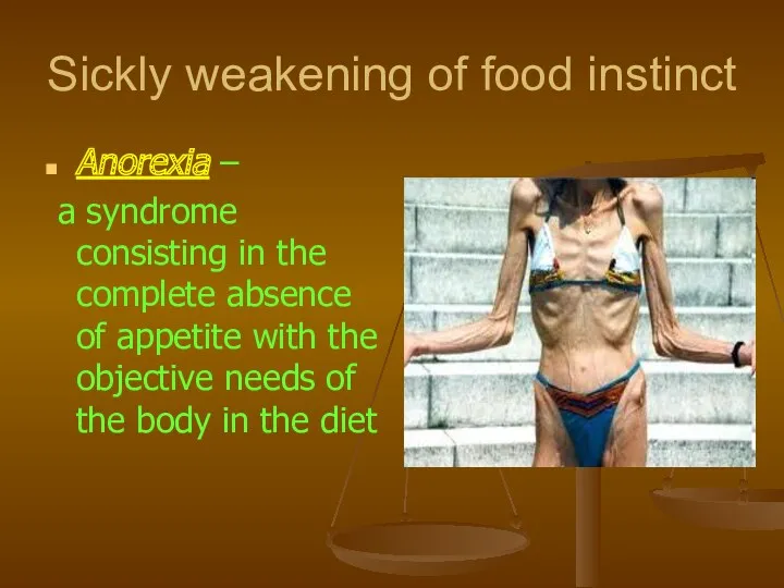 Sickly weakening of food instinct Anorexia – a syndrome consisting