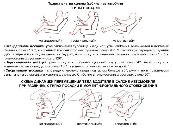 Травма внутри салона (кабины) автомобиля ТИПЫ ПОСАДКИ а «стандартный» б