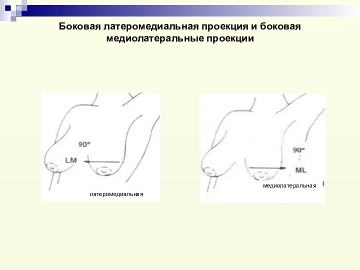 Боковая латеромедиальная проекция и боковая медиолатеральные проекции латеромедиальная медиолатеральная