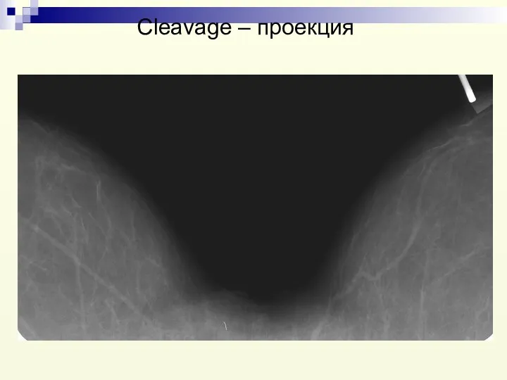 Cleavage – проекция