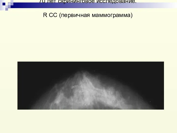 70 лет скрининговое исследование. R CC (первичная маммограмма)