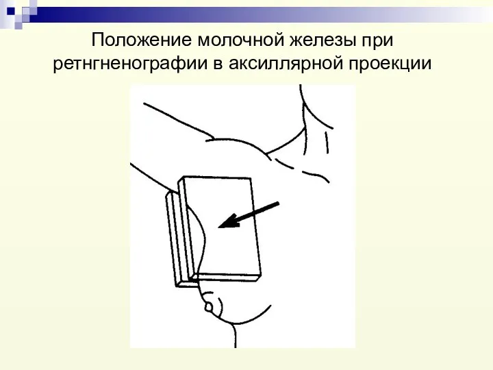 Положение молочной железы при ретнгненографии в аксиллярной проекции