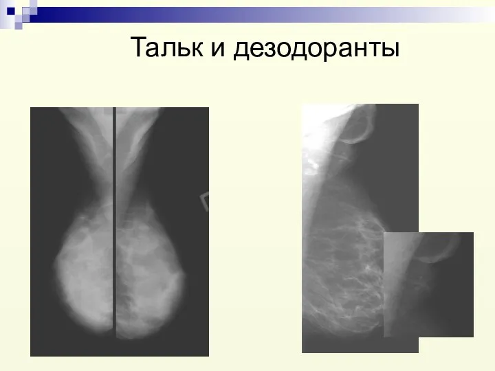 Тальк и дезодоранты