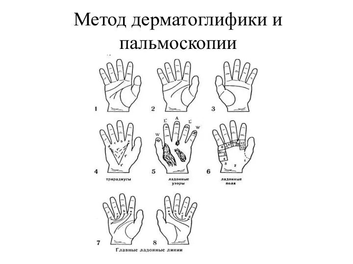 Метод дерматоглифики и пальмоскопии