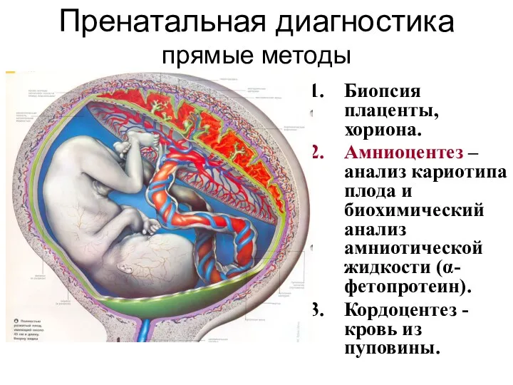 Пренатальная диагностика прямые методы Биопсия плаценты, хориона. Амниоцентез – анализ кариотипа плода и