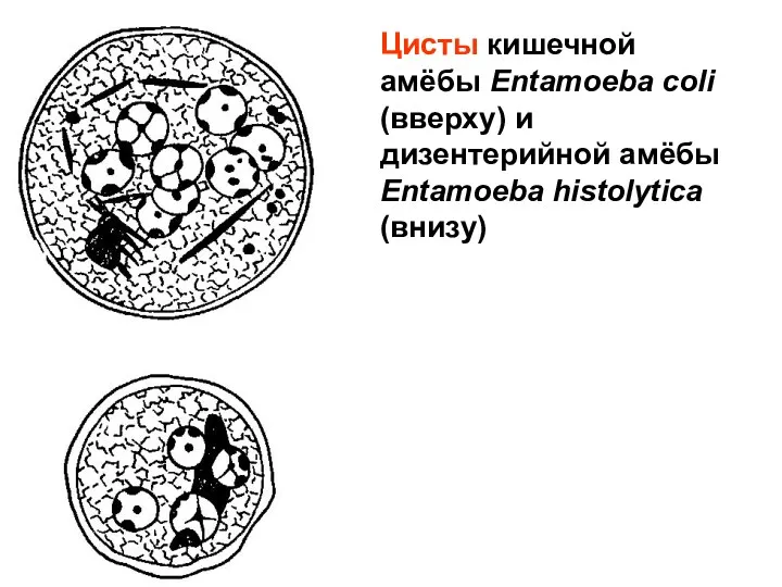 Цисты кишечной амёбы Entamoeba coli (вверху) и дизентерийной амёбы Entamoeba histolytica (внизу)