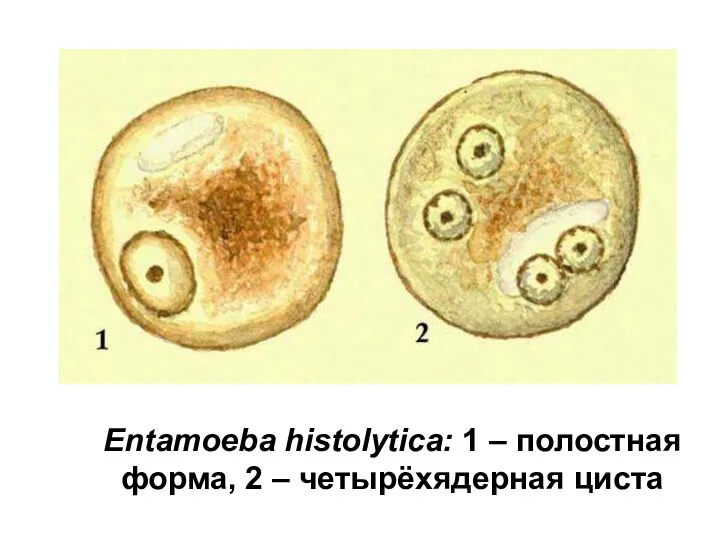 Entamoeba histolytica: 1 – полостная форма, 2 – четырёхядерная циста