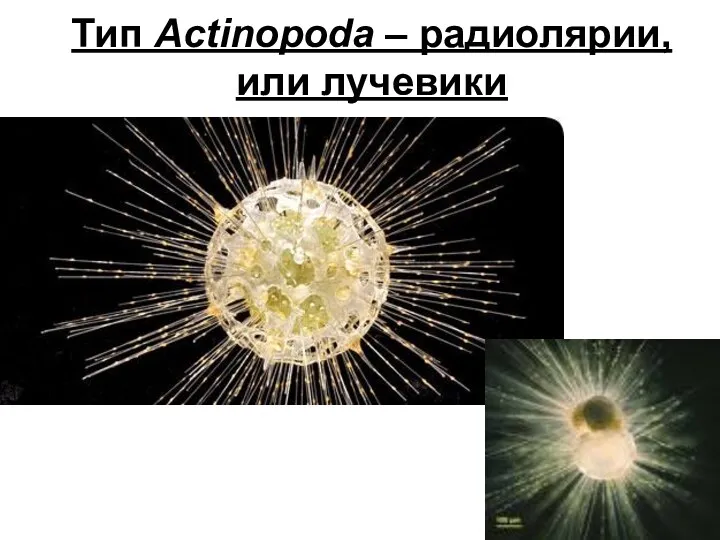 Тип Actinopoda – радиолярии, или лучевики