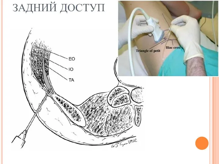 ЗАДНИЙ ДОСТУП