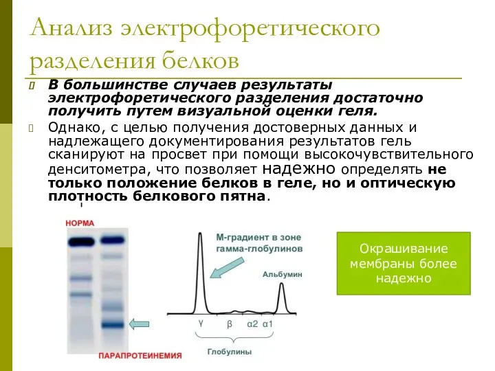 Анализ электрофоретического разделения белков В большинстве случаев результаты электрофоретического разделения