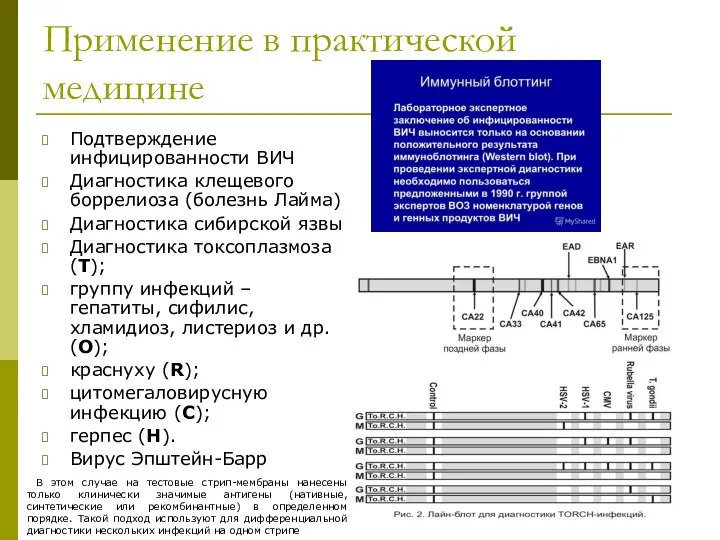 Применение в практической медицине Подтверждение инфицированности ВИЧ Диагностика клещевого боррелиоза