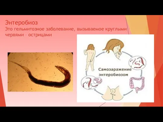 Энтеробиоз Это гельмитозное заболевание, вызываемое круглыми червями – острицами