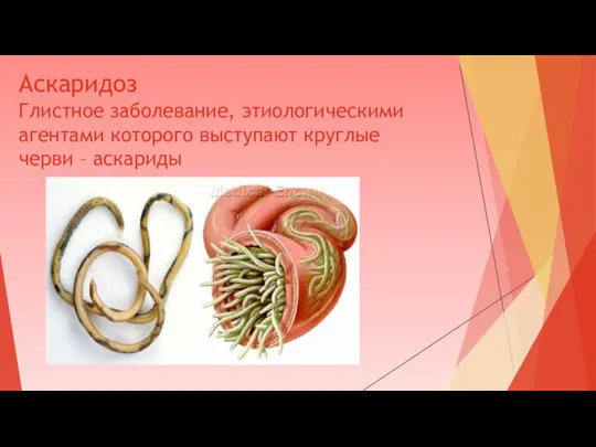 Аскаридоз Глистное заболевание, этиологическими агентами которого выступают круглые черви – аскариды