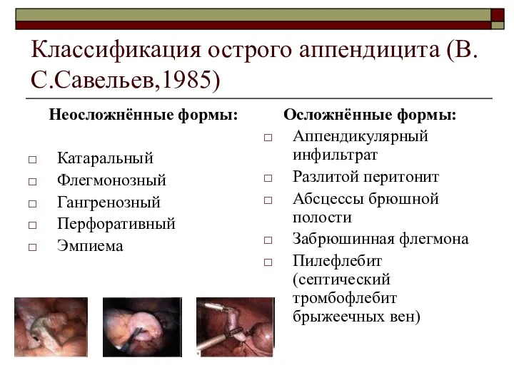 Классификация острого аппендицита (В.С.Савельев,1985) Неосложнённые формы: Катаральный Флегмонозный Гангренозный Перфоративный