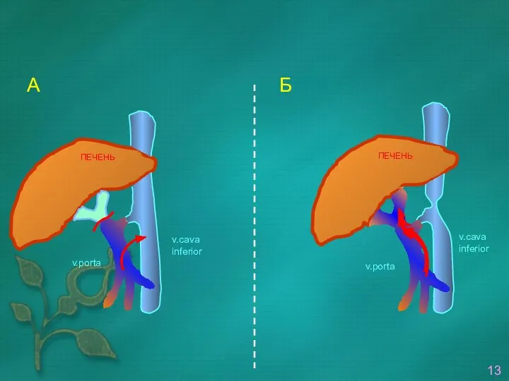 v.cava inferior v.porta ПЕЧЕНЬ ПЕЧЕНЬ v.cava inferior v.porta 13 А Б
