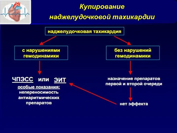 Купирование наджелудочковой тахикардии