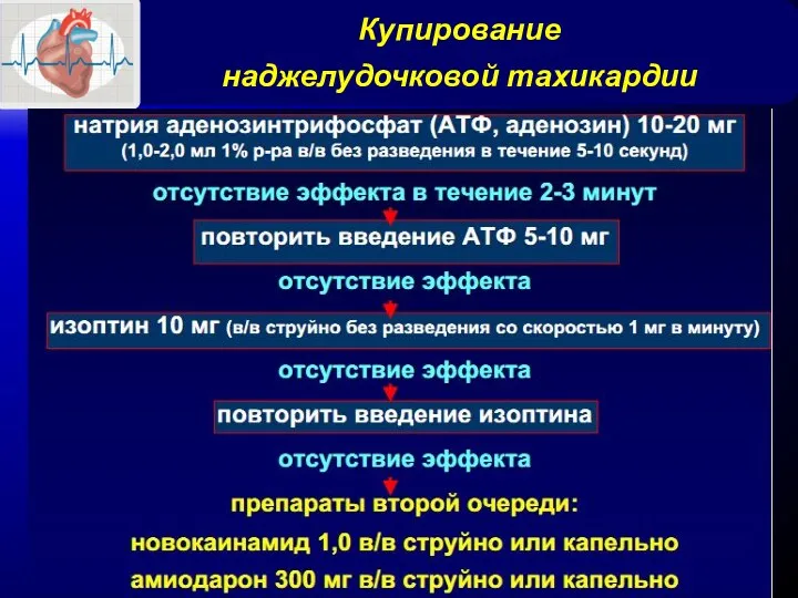 Купирование наджелудочковой тахикардии