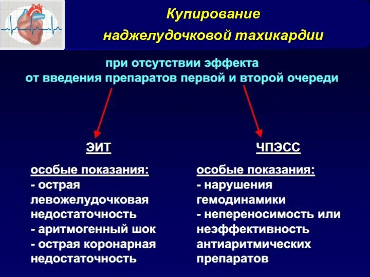 Купирование наджелудочковой тахикардии