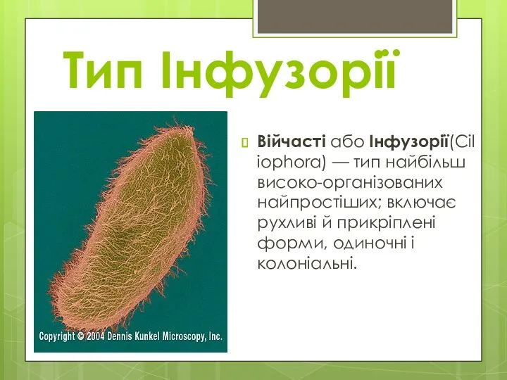 Тип Інфузорії Війчасті або Інфузорії(Ciliophora) — тип найбільш високо-організованих найпростіших;